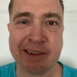 šmucler ochrnutý obličej