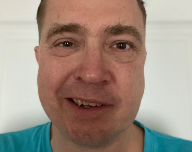 šmucler ochrnutý obličej