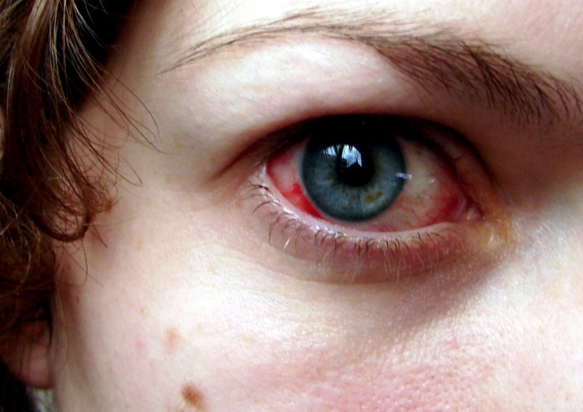 oční lékařka odmítla očkované