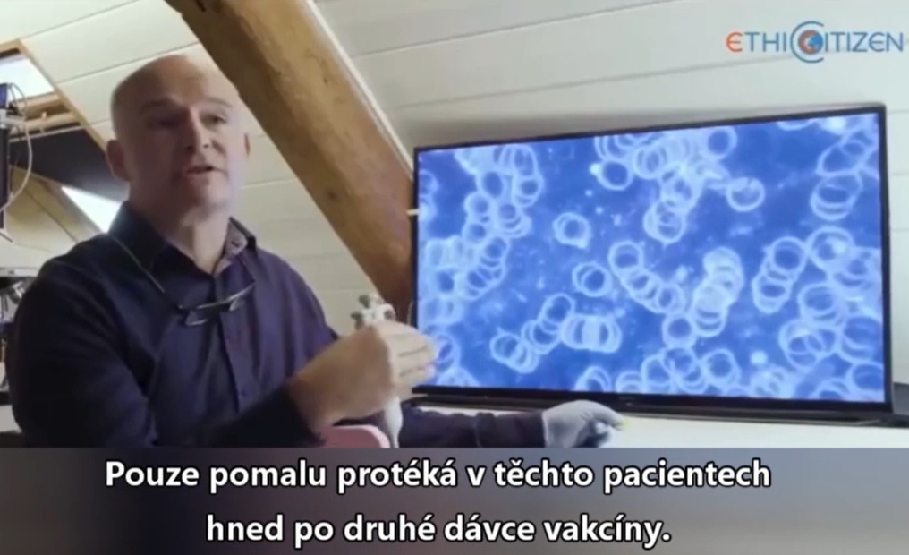 krev neočkovaných