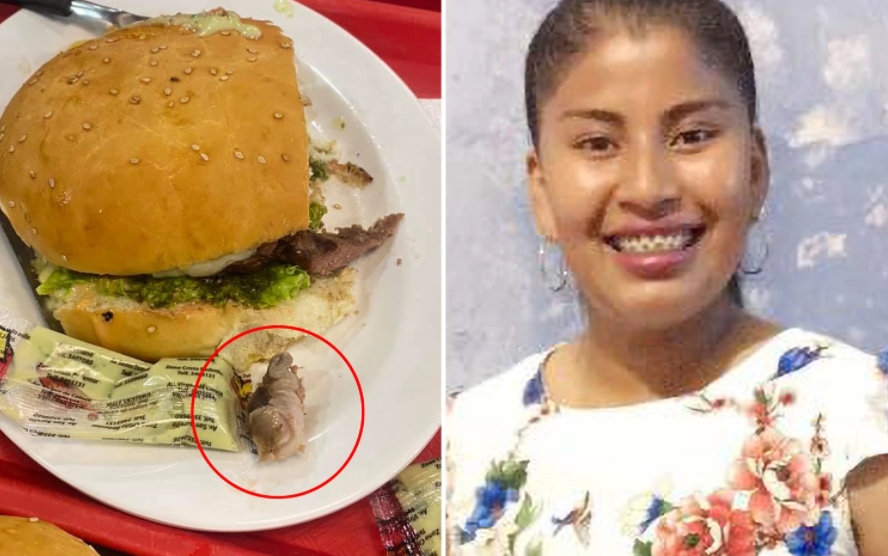 hnijící prst hamburger