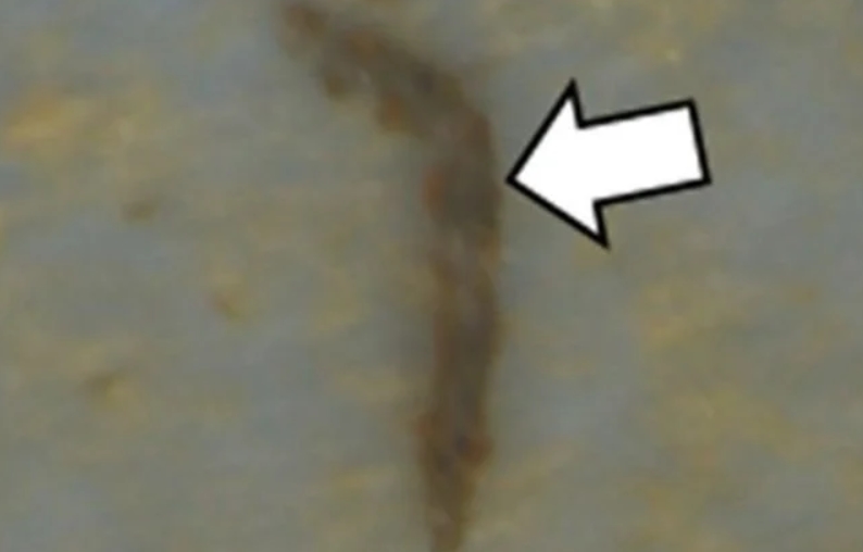 mikroplasty