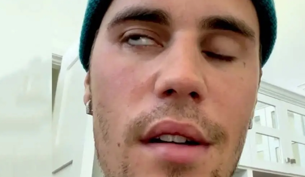 bieber ochrnutí