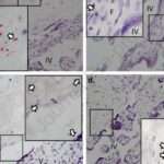spike protein mrna vakcíny placenta