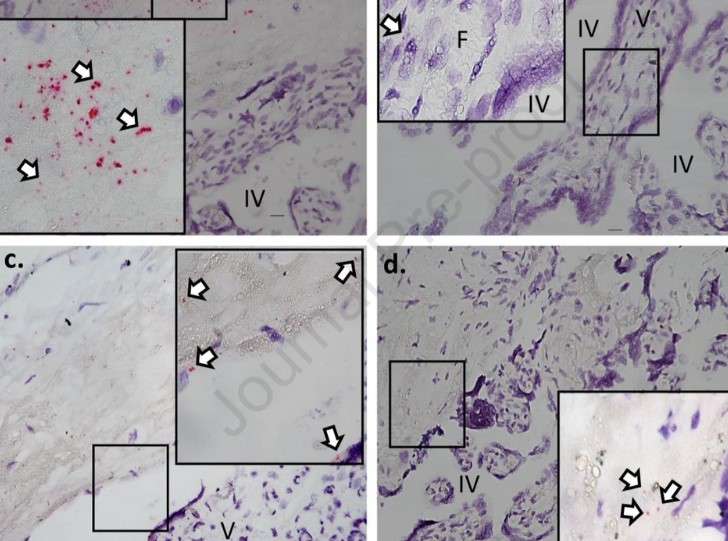 spike protein mrna vakcíny placenta